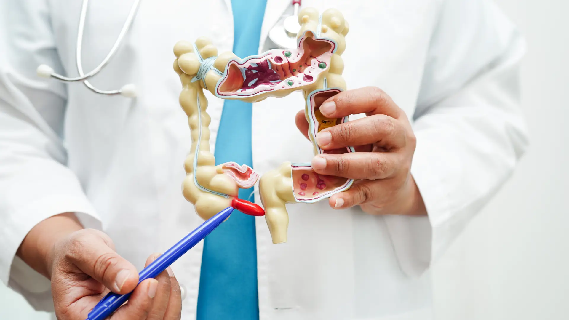 Fistula Treatment in Moshi