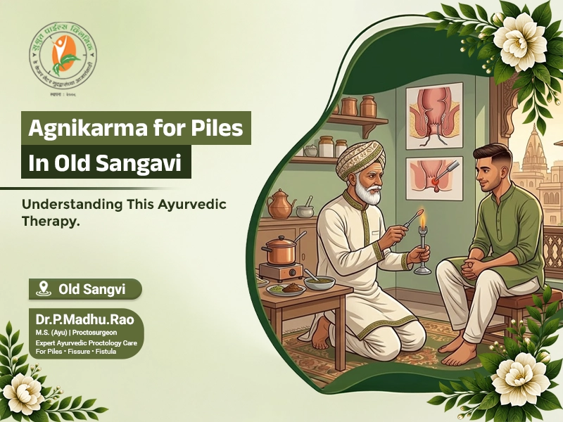 Agnikarma for Piles in Old Sangavi